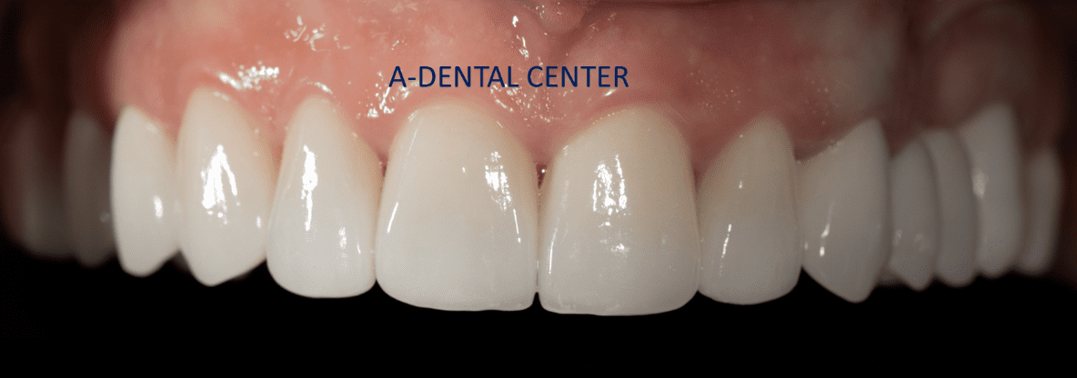 - A-Dental Center